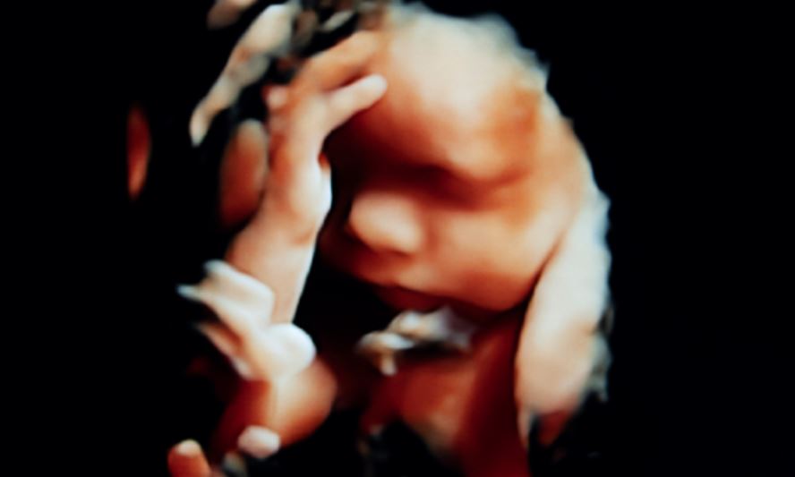 FLASH - Il North Dakota diventa il 15° stato USA che protegge i bambini dall'aborto 1